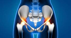 Read more about the article Hip Replacement: What to Expect Before, During, and After Surgery