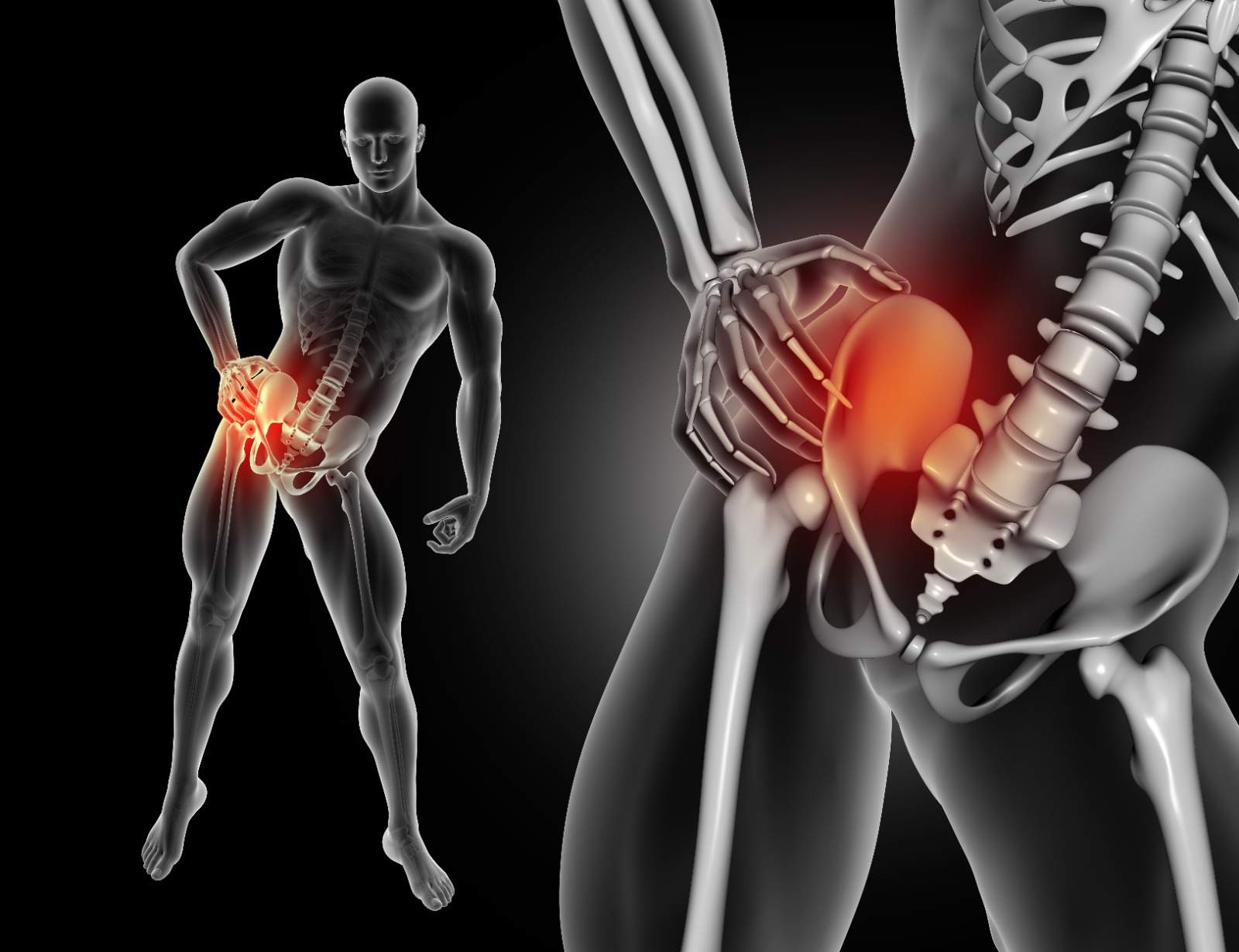 Anterior Hip Replacement Benefits